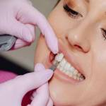 Cost of Teeth Veneers Profile Picture
