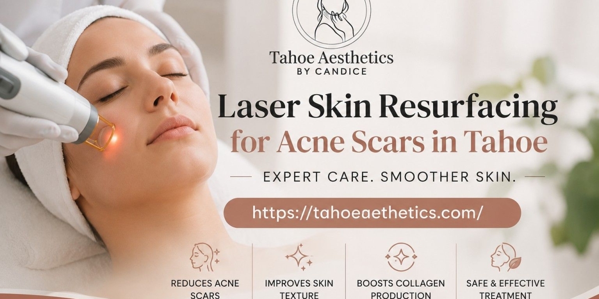 Laser Skin Resurfacing for Acne Scars in Tahoe | Expert Care