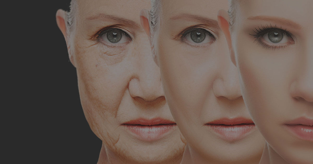 Microneedling RF Treatment in Hyderabad | Eudermiz