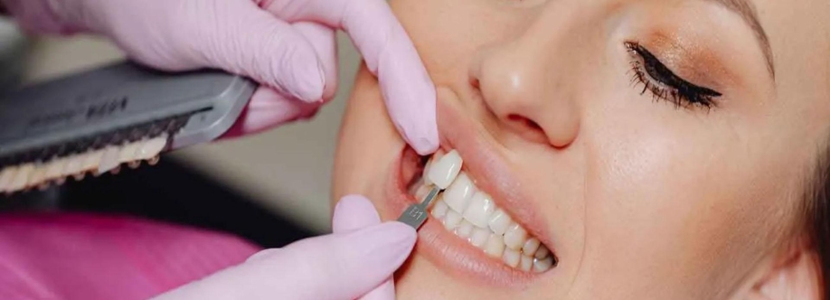 Cost of Teeth Veneers Cover Image