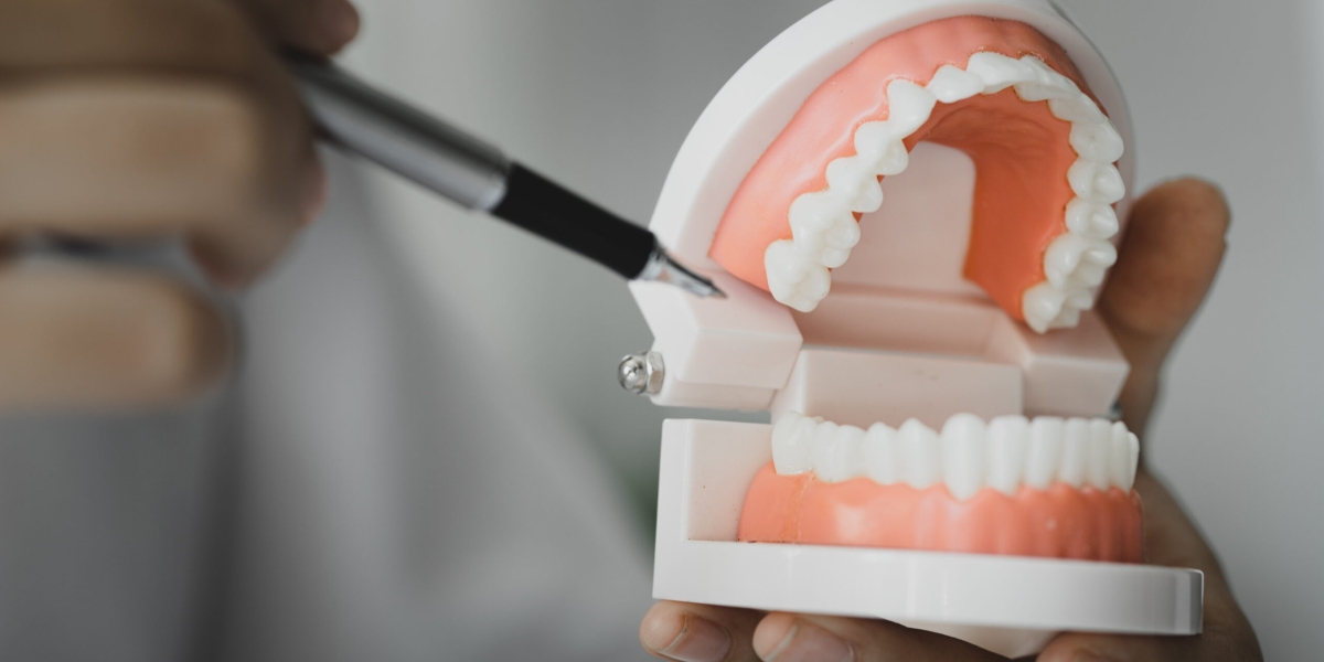Teeth Whitening Near Me: How to Find the Right Dentist Near Me for a Brighter Smile